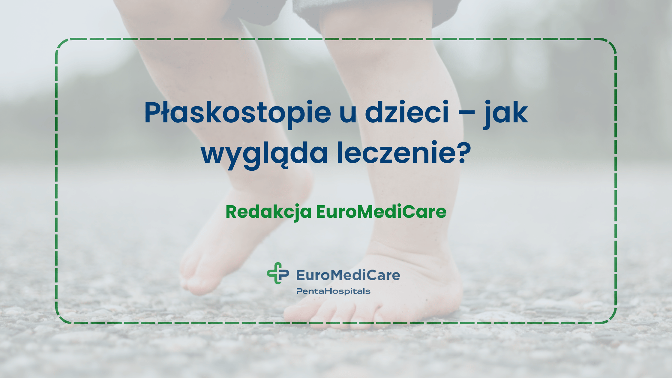 Płaskostopie u dzieci – jak wygląda leczenie? - blog euromedicare.pl